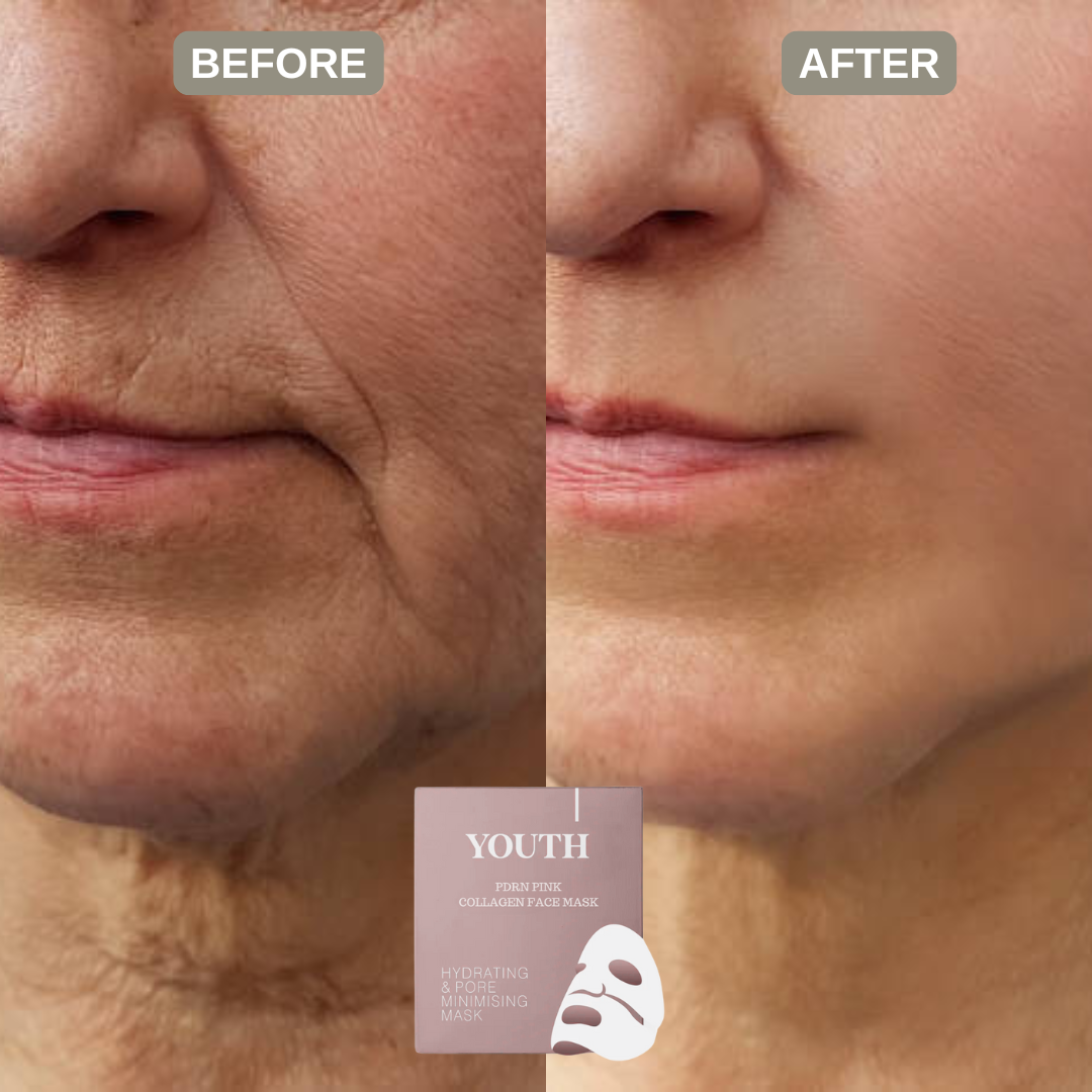 Youth® Salmon PDRN Pink Collagen Face Masks